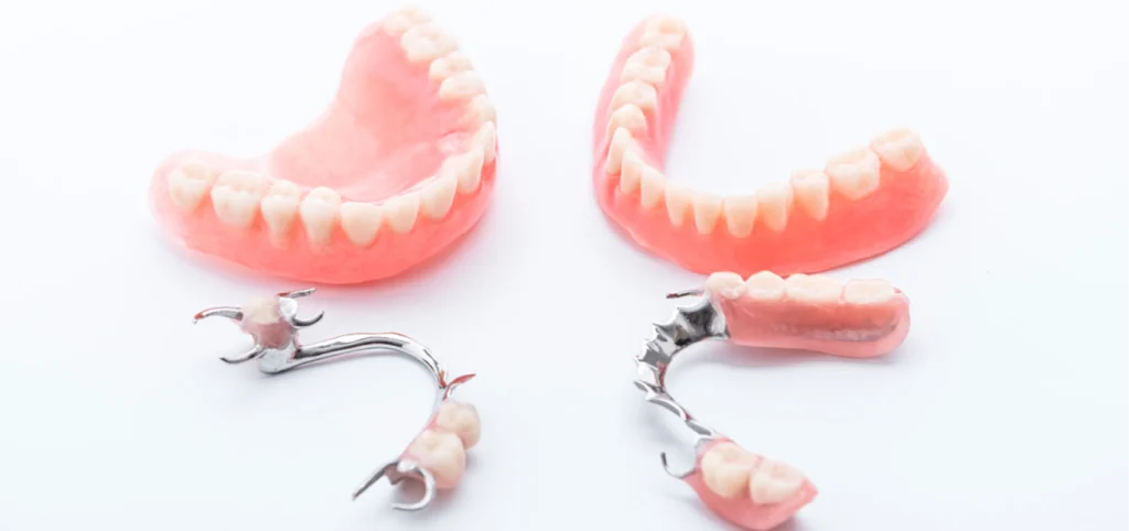 proth se fixe amovible nice Implantologie Cabinet dentaire Le 29 Bis | Chirurgiens-dentistes | Antony 92160